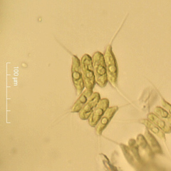 Desmodesmus protuberans