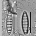 Denticula - Photo (c) aliendiatom, some rights reserved (CC BY-NC)