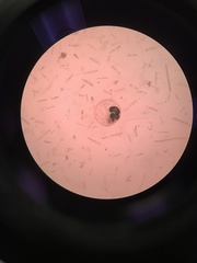 Noctiluca scintillans