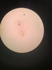 Noctiluca scintillans