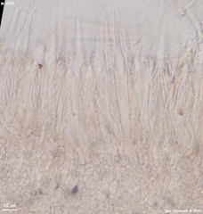 Trichopeziza mollissima