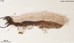 Trichopeziza mollissima