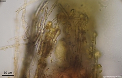 Trichopeziza mollissima