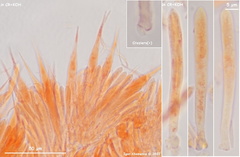 Trichopeziza mollissima