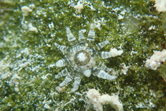 Bunodeopsis globulifera