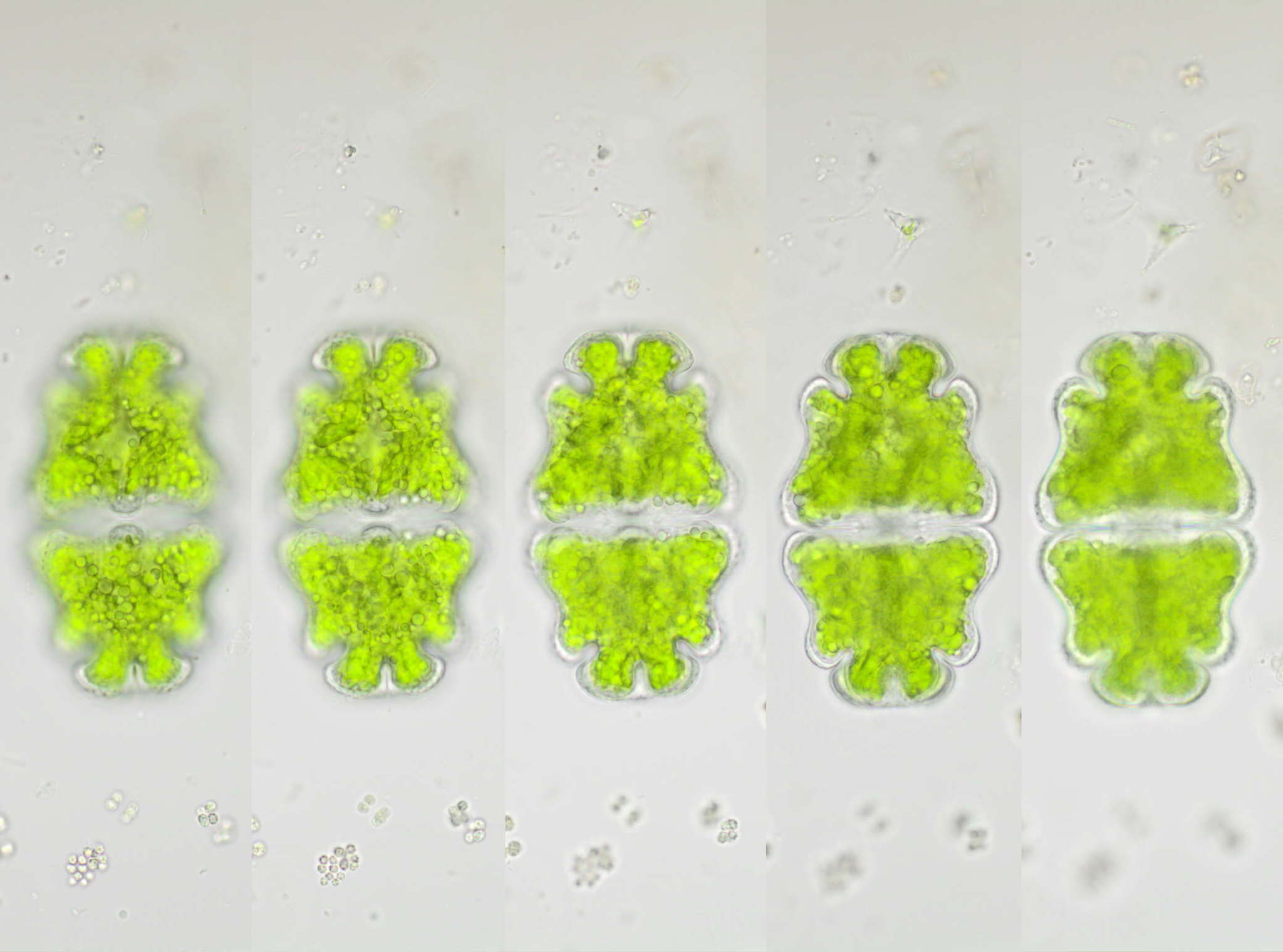Euastrum ventricosum