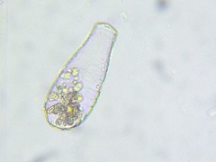 Quadrulella symmetrica