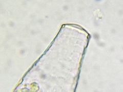 Quadrulella symmetrica