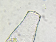 Quadrulella symmetrica