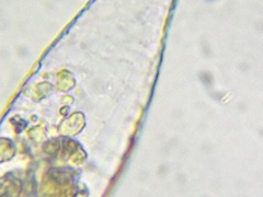 Quadrulella symmetrica