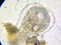 Quadrulella symmetrica