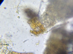 Quadrulella symmetrica