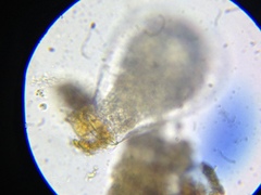 Quadrulella symmetrica