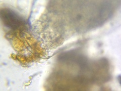 Quadrulella symmetrica