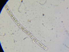 Microspora