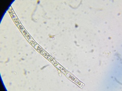 Microspora