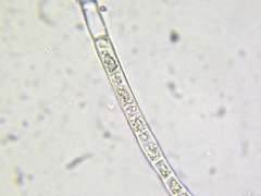 Microspora
