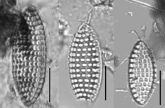 Tryblionella granulata