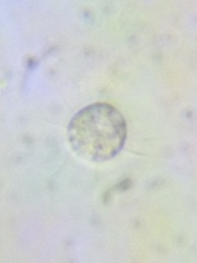Acanthocystis