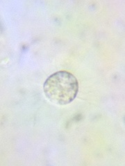 Acanthocystis