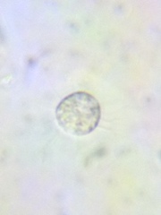 Acanthocystis