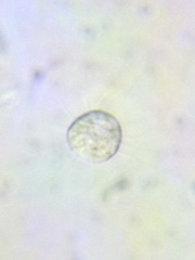 Acanthocystis