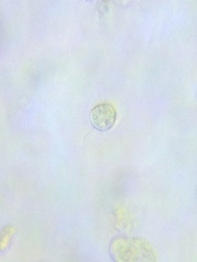 Acanthocystis