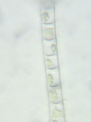 Microspora