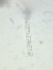 Microspora