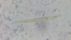 Atractomorpha echinata