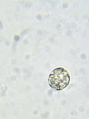Acanthocystis
