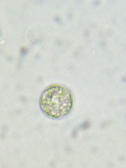 Acanthocystis