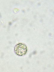 Acanthocystis