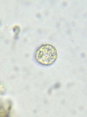 Acanthocystis