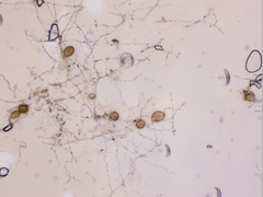 Podosphaera amelanchieris