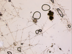 Podosphaera amelanchieris