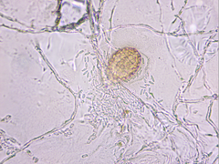 Podosphaera amelanchieris