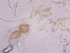 Podosphaera amelanchieris