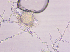 Podosphaera amelanchieris