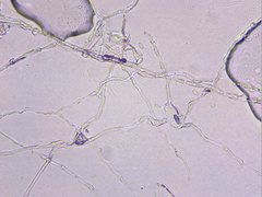 Podosphaera amelanchieris