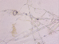 Podosphaera amelanchieris