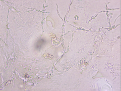 Podosphaera amelanchieris