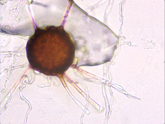 Podosphaera amelanchieris