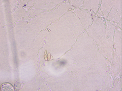 Podosphaera amelanchieris