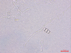 Podosphaera amelanchieris