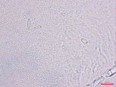 Podosphaera amelanchieris