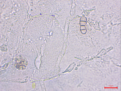 Podosphaera amelanchieris