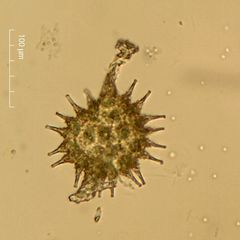 Pseudopediastrum boryanum longicorne