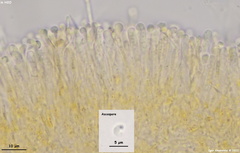 Orbilia xanthostigma