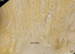 Ramsbottomia asperior